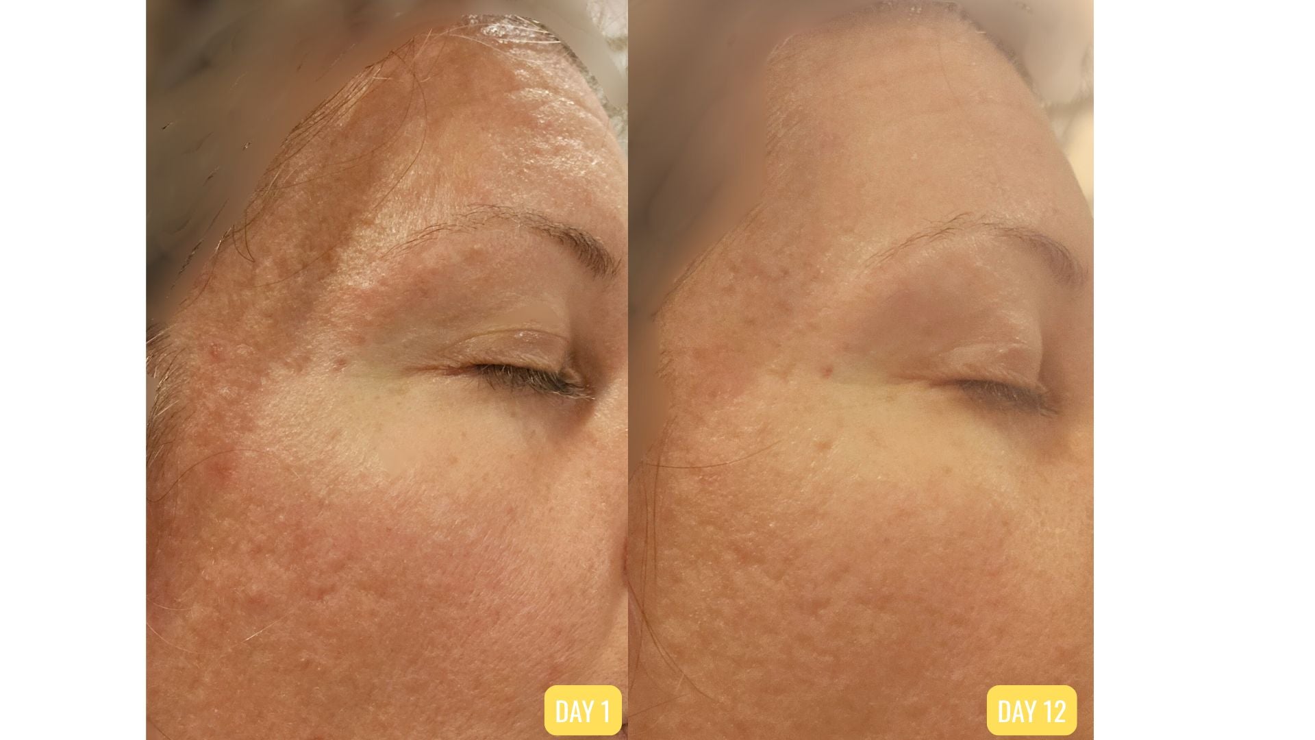 Healmi Gentle Skin Barrier Repair Ritual