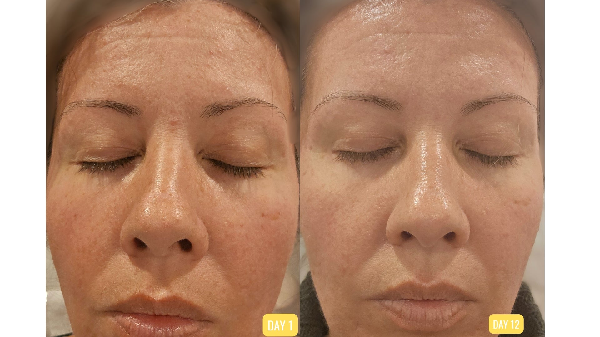 Healmi Gentle Skin Barrier Repair Ritual