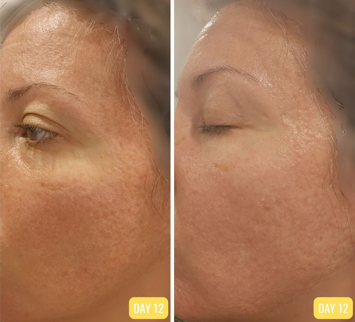 Healmi Gentle Skin Barrier Repair Ritual